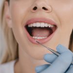 Em uma imagem close-up, uma mulher de pele branca e cabelos loiros está com sua boca aberta enquanto um profissional examina seus dentes inferiores com um instrumento.