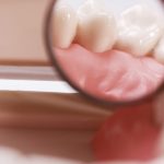 A imagem mostra um espelho odontológico. Eles e entre duas arcadas dentárias e reflete um dos dentes.