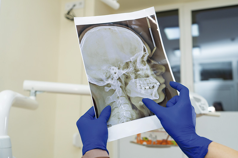 Na imagem, uma pessoa está segurando uma radiografia e medindo a distância entre dois pontos no raio x. No fundo da foto está um aparelho branco. A pessoa está usando luvas médicas azuis.